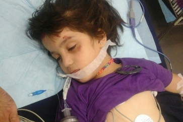 طفلة فلسطينية توفيت نتيجة نقص خدمات الانروا