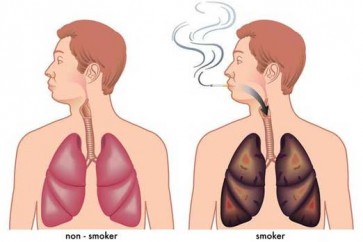 مشروب طبيعي يطهّر الرئتين من آثار التدخين