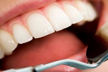 الطريقة الجديدة تشجع الترميم الطبيعي للأسنان