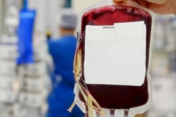 قد يبدأ الاستخدام الطبي للدم الصناعي مع الحالات ذات فصائل الدم النادرة