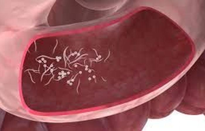 الشعيرات الدموية المنقذة للحشرات تنظف الأمعاء من الديدان Dsvdedommel Com