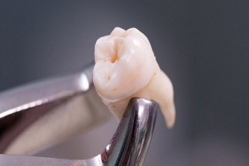 دراسة تحدد أثر مضغ الطعام على أسناننا