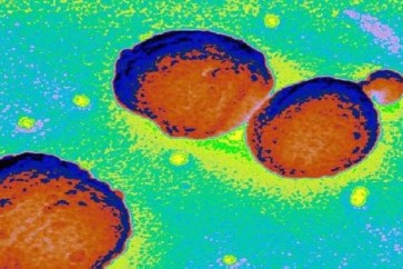 علماء يحذرون من بكتيريا ثلاثية الأخطار!