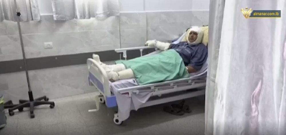 رغم الحصار اطباء الحروق في غزة يعالجون الاف المصابين