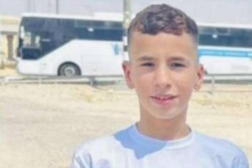عبد الرحمن الزغل الطفل الفلسطيني المصاب