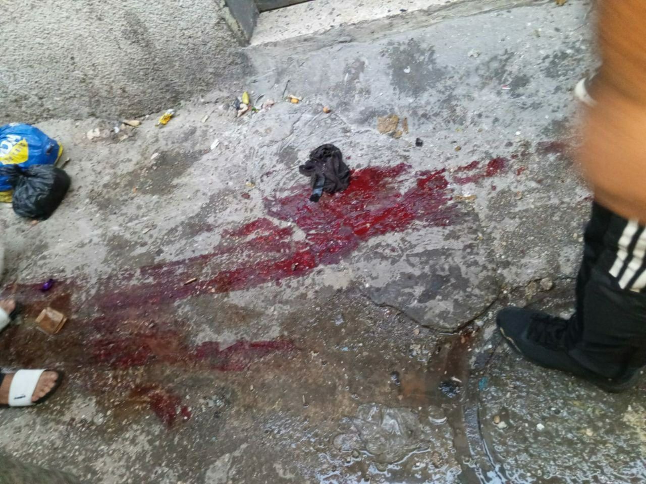 دماء جنود الاحتلال المصابين خلال الاشتباكات التي اندلعت في مخيم طولكرم